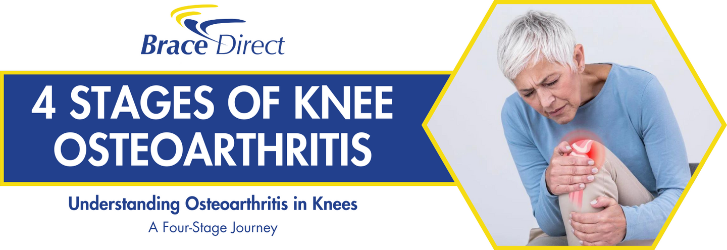 The 4 Stages of Knee Osteoarthritis - Brace Direct