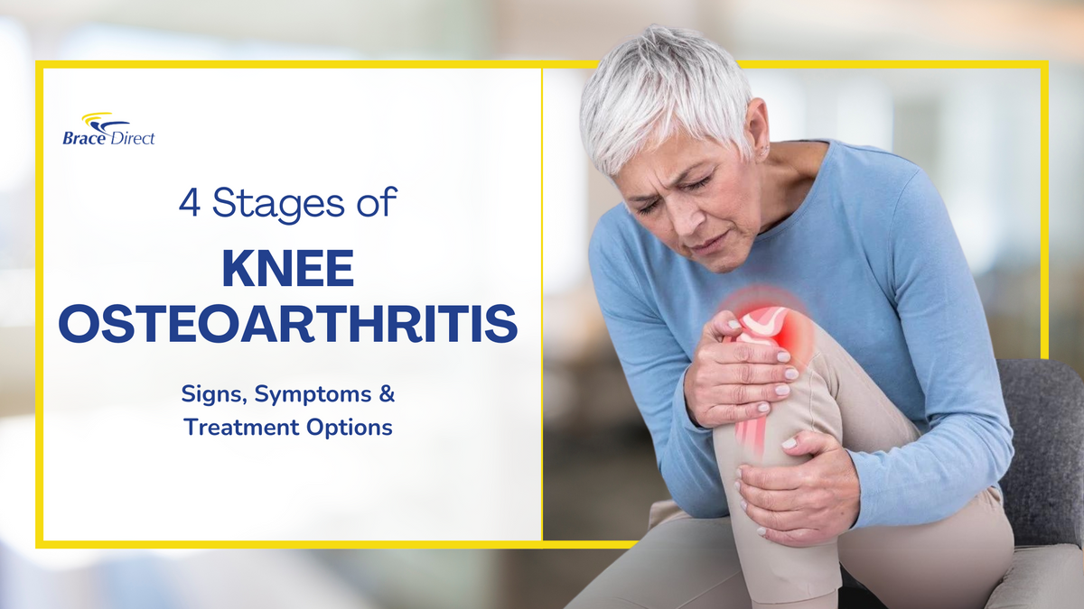 Navigating Knee Osteoarthritis: Understanding the Four Stages