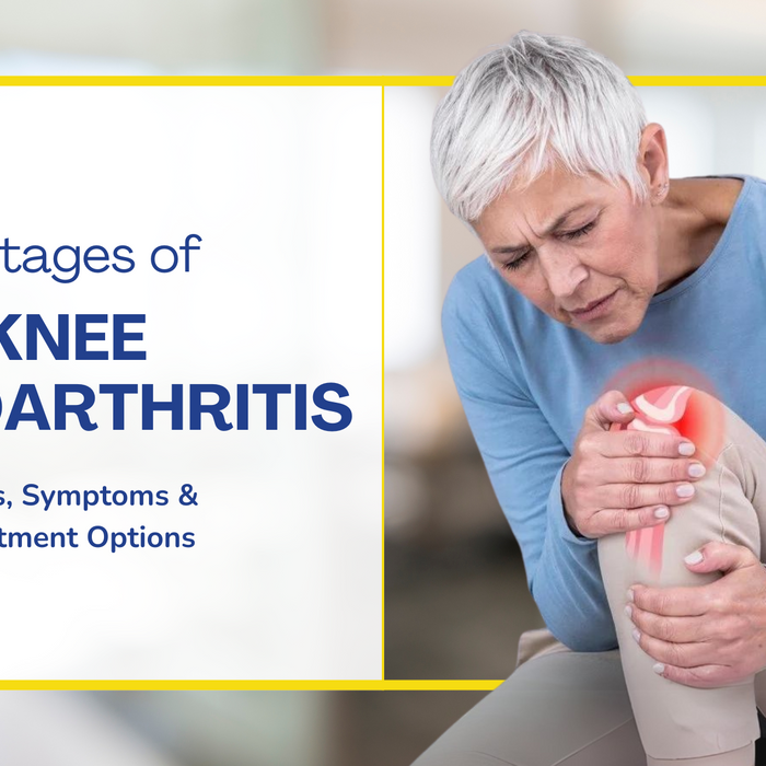 Navigating Knee Osteoarthritis: Understanding the Four Stages