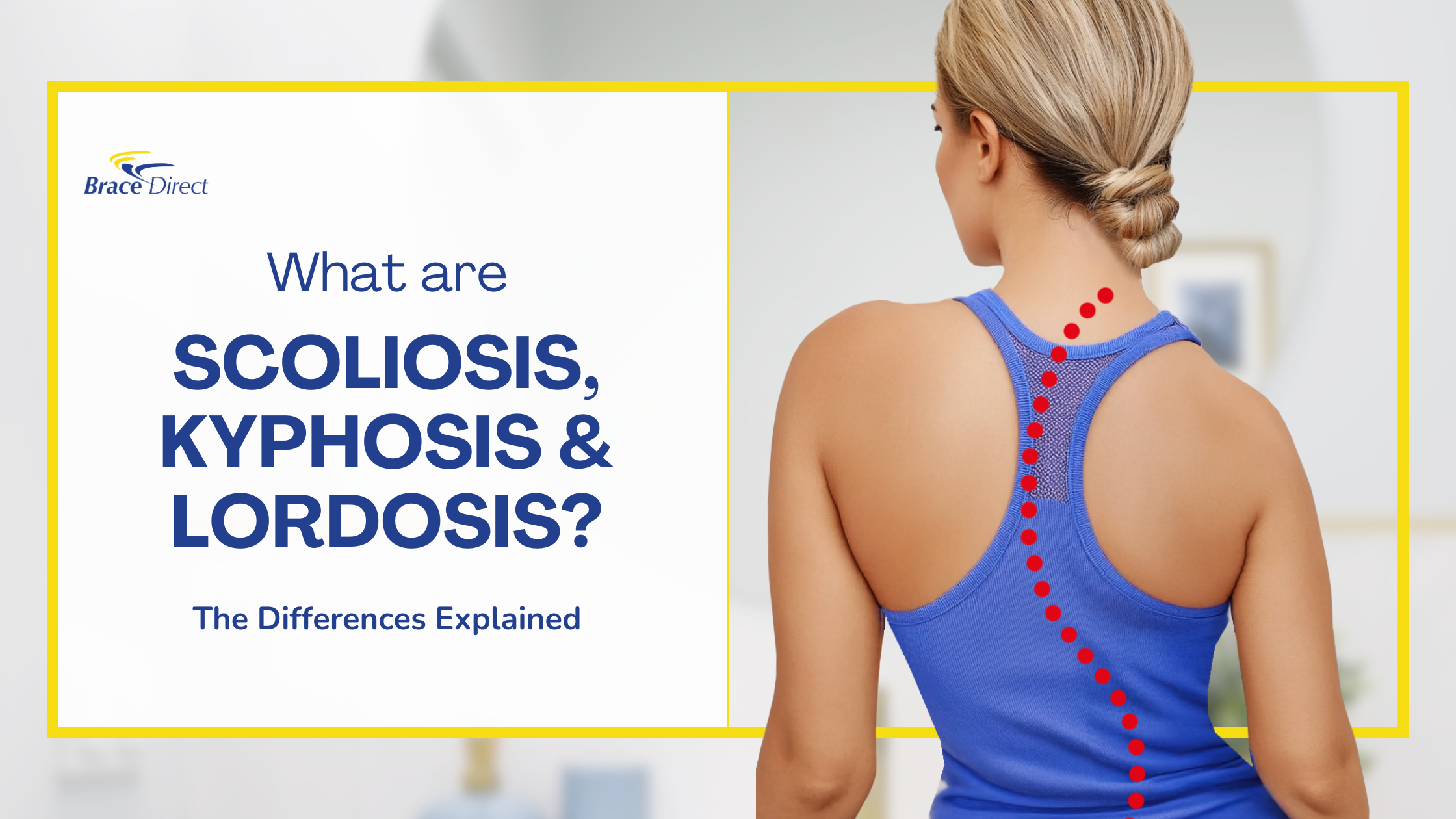 The Differences Between Scoliosis, Kyphosis & Lordosis