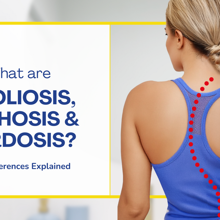 What are Scoliosis, Kyphosis, and Lordosis?