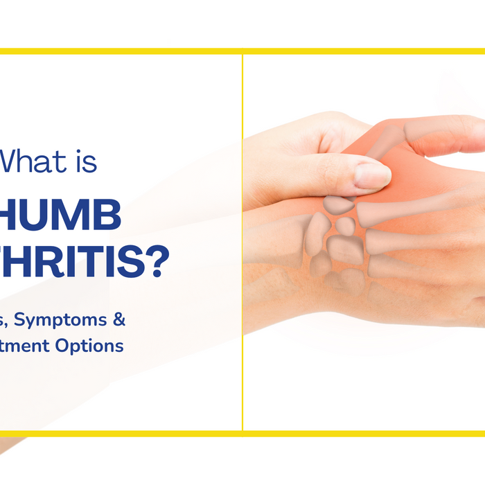 Thumb Arthritis - Signs, Symptoms & Treatment Options