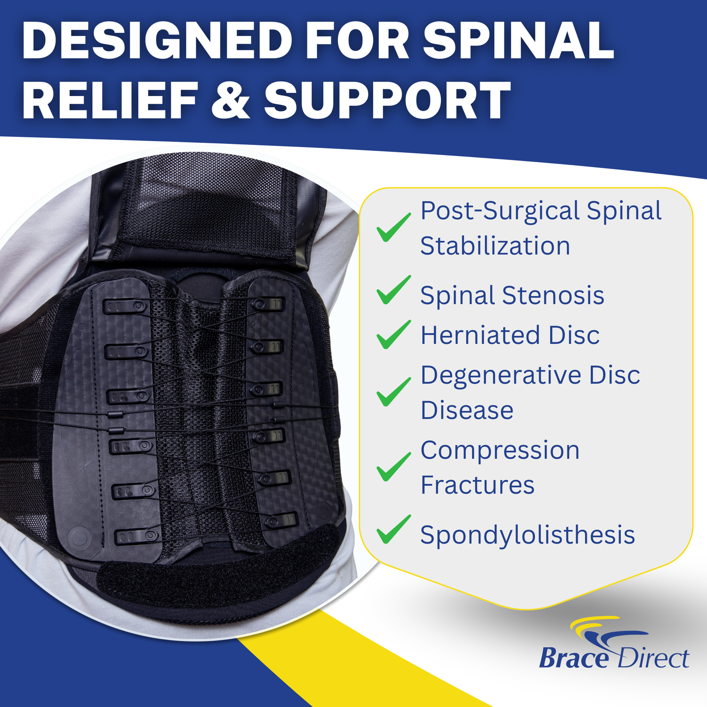 Brace Align Core Pro LSO Back Brace - Lumbar Sacral Orthosis with 6:1 ...