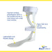 Lightweight AFO for Foot Drop Recovery | Brace Align Swedish Leaf ...